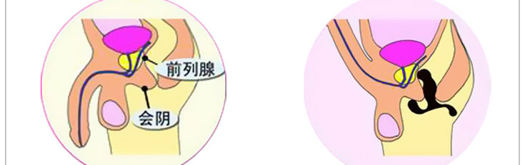 %e6%8c%89%e6%91%a9%e5%99%a8