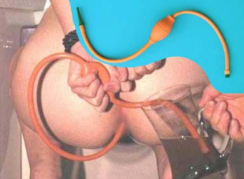 wkhqplzdwomebw3faaaaabkk08c871